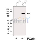 Western blot analysis of extracts from PC-3 cells, using MICAL2 Antibody. The lane on the left was treated with blocking peptide.