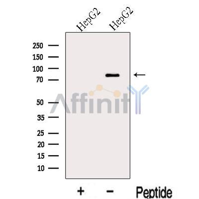 Western blot analysis of extracts from HepG2 cells, using MIPEP Antibody. The lane on the left was treated with blocking peptide.