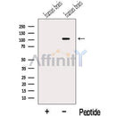 Western blot analysis of extracts from Human brain tissue, using MLK2 Antibody. The lane on the left was treated with blocking peptide.