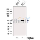 Western blot analysis of extracts from MCF-7 cells, using MLN64 Antibody. The lane on the left was treated with blocking peptide.