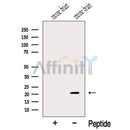 Western blot analysis of extracts from Mouse brain tissue, using MOBP Antibody. The lane on the left was treated with blocking peptide.