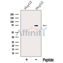 Western blot analysis of extracts from HepG2 cells, using MRPP3 Antibody. The lane on the left was treated with blocking peptide.