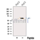 Western blot analysis of extracts from HepG2 cells, using MTF2 Antibody. The lane on the left was treated with blocking peptide.