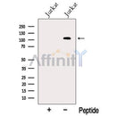 Western blot analysis of extracts from Jurkat cells, using MTUS1 Antibody. The lane on the left was treated with blocking peptide.