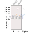 Western blot analysis of extracts from Mouse muscle tissue, using MYOM3 Antibody. The lane on the left was treated with blocking peptide.