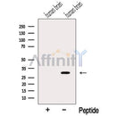 Western blot analysis of extracts from Human brain tissue, using Myozenin2 Antibody. The lane on the left was treated with blocking peptide.