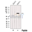 Western blot analysis of extracts from HeLa cells, using NCOA5 Antibody. The lane on the left was treated with blocking peptide.