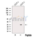 Western blot analysis of extracts from HeLa cells, using NDUFAF2 Antibody. The lane on the left was treated with blocking peptide.