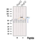 Western blot analysis of extracts from HepG2 cells, using NELFB Antibody. The lane on the left was treated with blocking peptide.