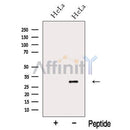 Western blot analysis of extracts from HeLa cells, using NIP30 Antibody. The lane on the left was treated with blocking peptide.