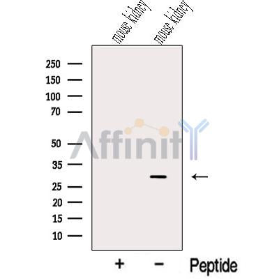 Western blot analysis of extracts from Mouse kidney tissue, using NIT2 Antibody. The lane on the left was treated with blocking peptide.