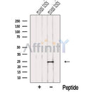 Western blot analysis of extracts from Mouse testis tissue, using NME5 Antibody. The lane on the left was treated with blocking peptide.