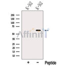 Western blot analysis of extracts from K-562 cells, using NOP58 Antibody. The lane on the left was treated with blocking peptide.