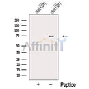 Western blot analysis of extracts from Mouse kidney tissue, using NPLOC4 Antibody. The lane on the left was treated with blocking peptide.