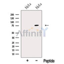 Western blot analysis of extracts from HeLa cells, using NR1D2 Antibody. The lane on the left was treated with blocking peptide.