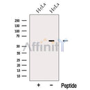 Western blot analysis of extracts from HeLa cells, using nucleobindin1 Antibody. The lane on the left was treated with blocking peptide.