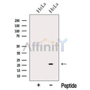 Western blot analysis of extracts from HeLa cells, using NUDT16 Antibody. The lane on the left was treated with blocking peptide.