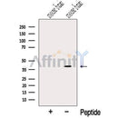 Western blot analysis of extracts from Mouse brain tissue, using NUDT9 Antibody. The lane on the left was treated with blocking peptide.
