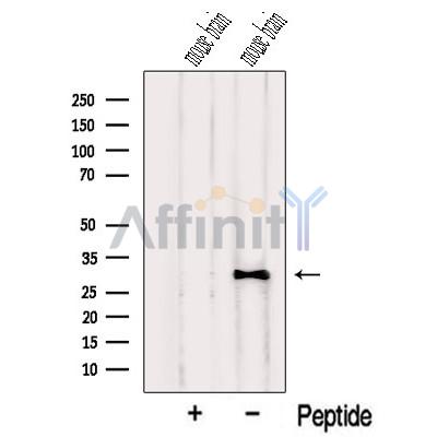 Western blot analysis of extracts from Mouse brain tissue, using NUS1 Antibody. The lane on the left was treated with blocking peptide.