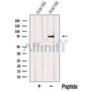 Western blot analysis of extracts from Mouse testis tissue, using NXF2 Antibody. The lane on the left was treated with blocking peptide.