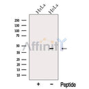 Western blot analysis of extracts from HeLa cells, using OFD1 Antibody. The lane on the left was treated with blocking peptide.