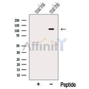 Western blot analysis of extracts from Mouse brain tissue, using OGDHL Antibody. The lane on the left was treated with blocking peptide.
