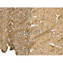 Neurofilament heavy polypeptide Antibody -DF13211