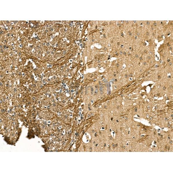Neurofilament heavy polypeptide Antibody -DF13211