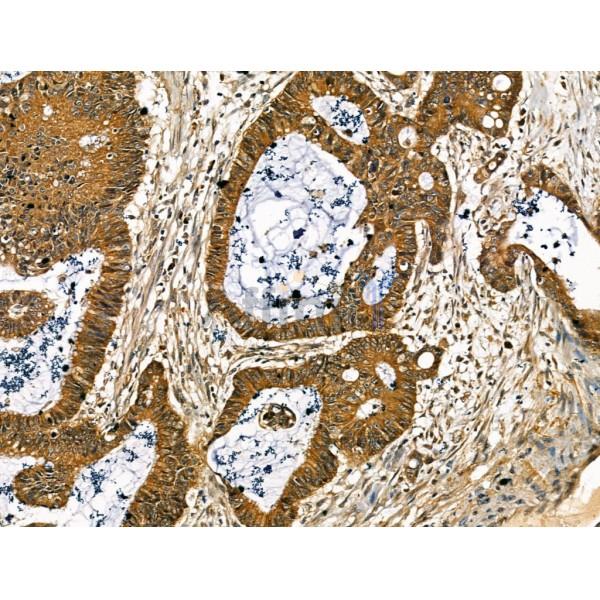 Collagen X Antibody -DF13214