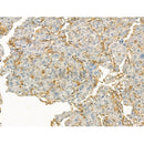 Clathrin Antibody -DF13215