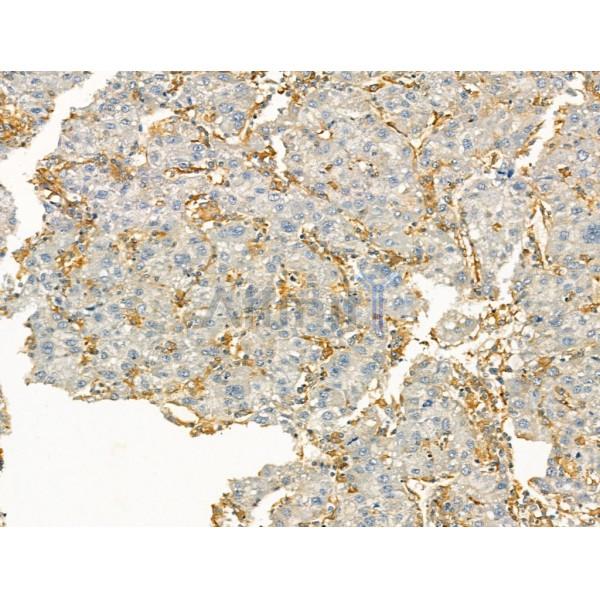 Clathrin Antibody -DF13215