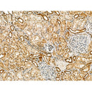 Carbonic Anhydrase IX Antibody -DF13218