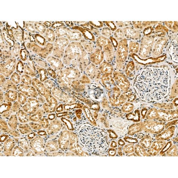 Carbonic Anhydrase IX Antibody -DF13218