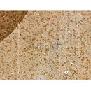 GJB6 Antibody -DF13225