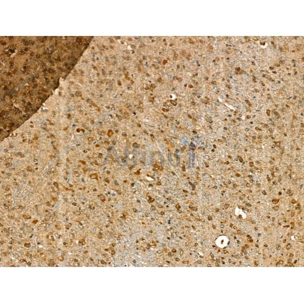 GJB6 Antibody -DF13225