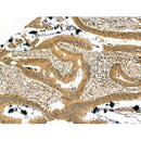 Prolyl Endopeptidase Antibody -DF13228