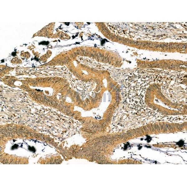 Prolyl Endopeptidase Antibody -DF13228