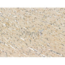 Methyltransferase like 5 Antibody -DF13232