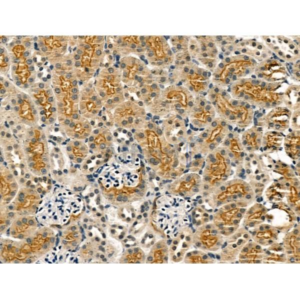 KCNN3 Antibody -DF13233