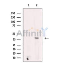 Stra8 Antibody -DF13234