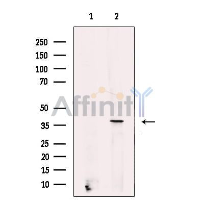 Stra8 Antibody -DF13234