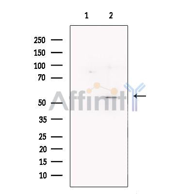 FOXG1 Antibody -DF13235