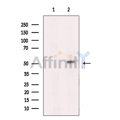 P2X2 Antibody -DF13236