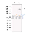 Tenascin-N Antibody -DF13237