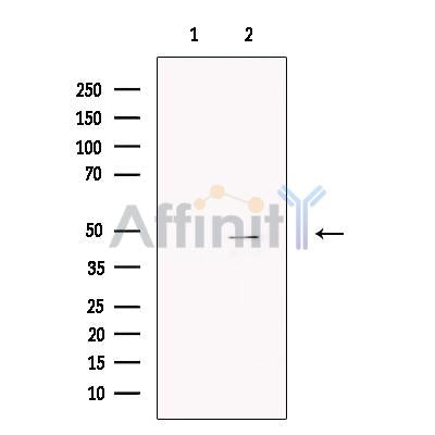 Brachyury / Bry Antibody -DF13238