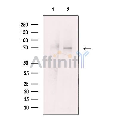 KCNC2 Antibody -DF13240