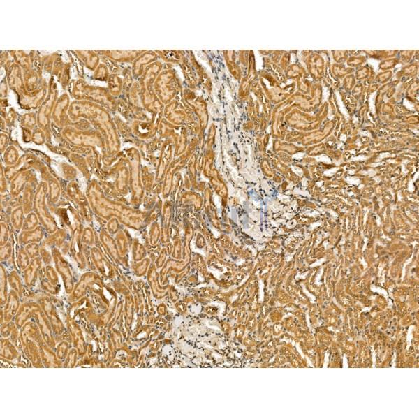 Nav1.8 Antibody -DF13241