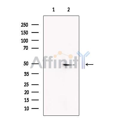 KCNK2 Antibody -DF13242