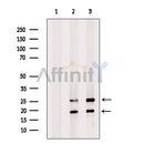 Somatostatin Antibody -DF13243