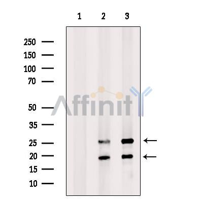 Somatostatin Antibody -DF13243